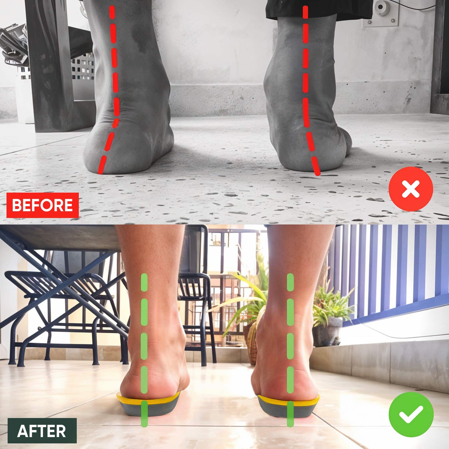 Arch Support Gel Insoles
