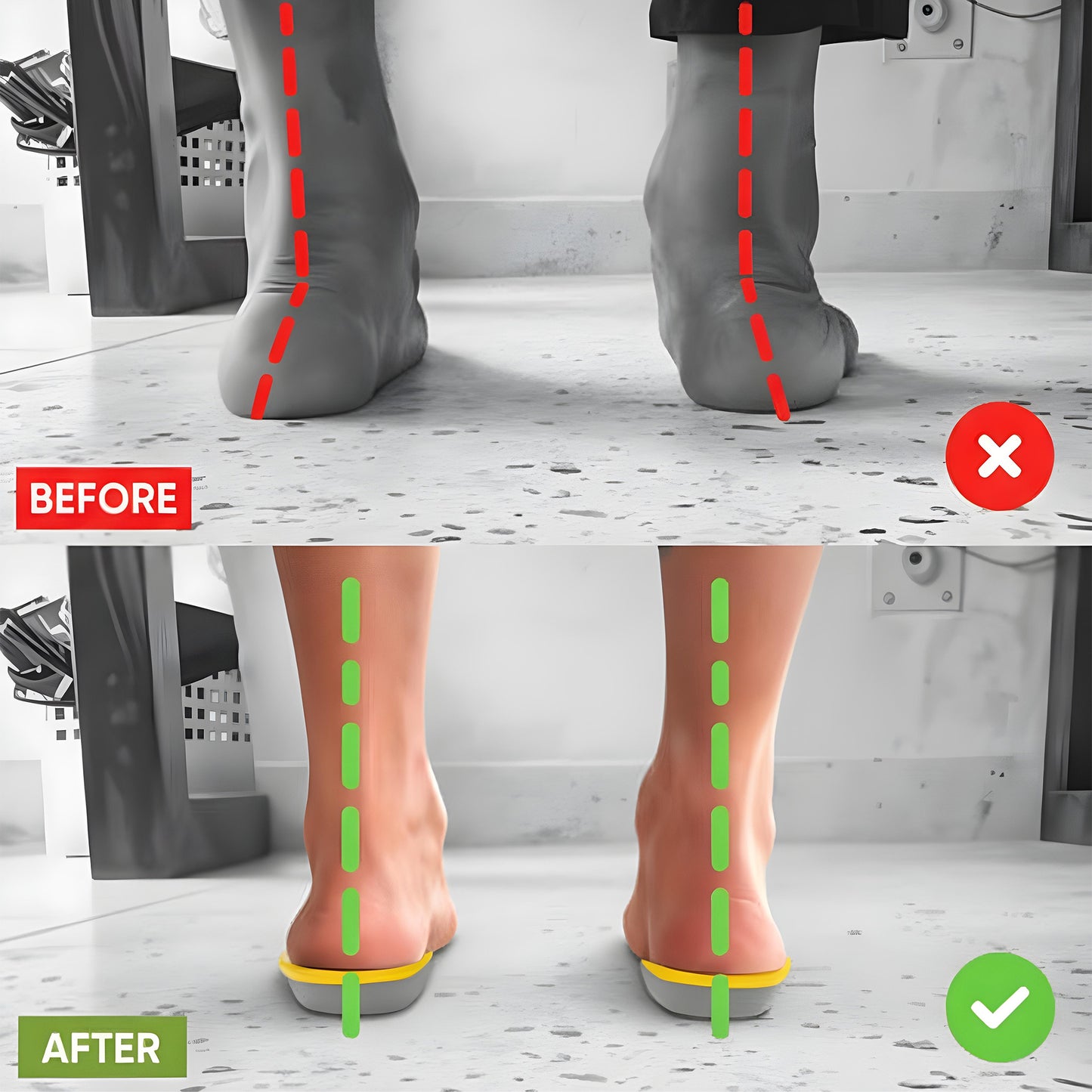 Ortho Gel Insoles for Shoes with Arch Support
