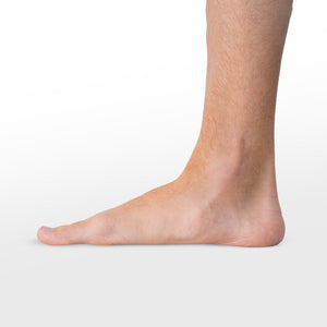Flat Feet