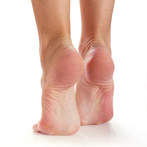 Plantar Fasciitis